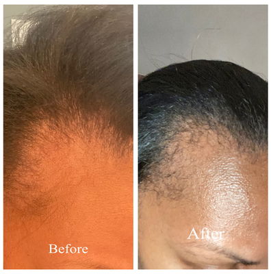 Hair Boost Serum with MSM - Ashley Marie Collection by The Hair