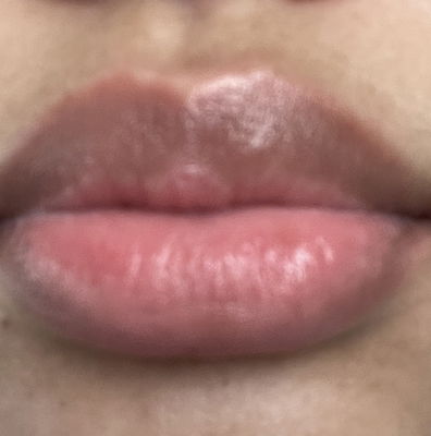 Home | lipfidence
