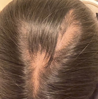 Hair Growth Serum Intense with Copper Peptide GHK-Cu